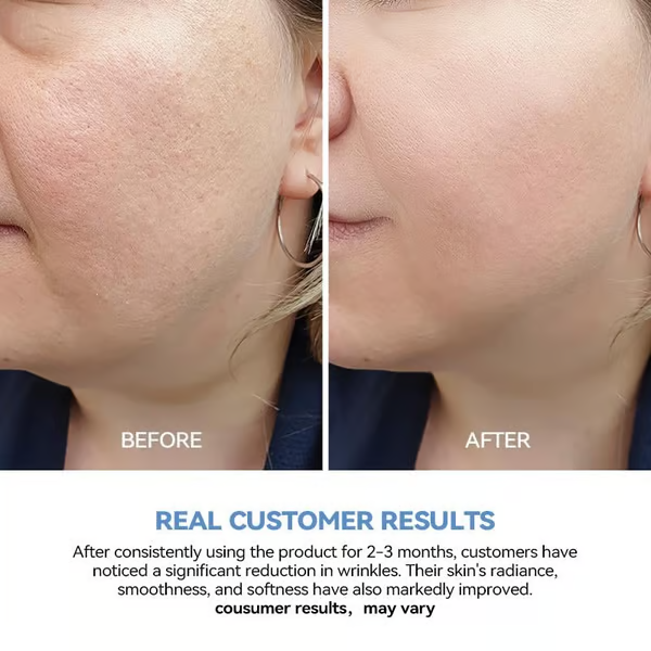 3% Hyaluronic Acid Glass Skin Single-Use Vials Skincare Comfort