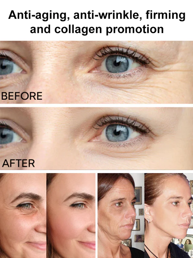 Collagen Anti-Wrinkle Cream