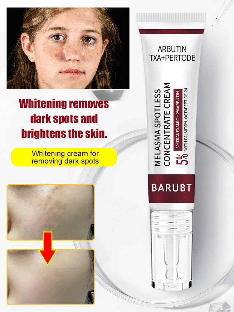 Whitening and spot cream