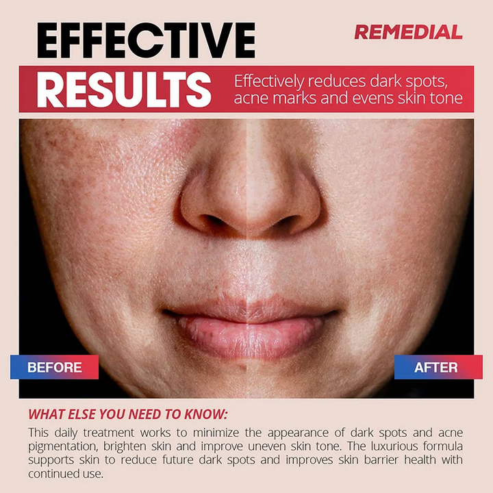 ASMOXA Dark Spot Corrector Cream