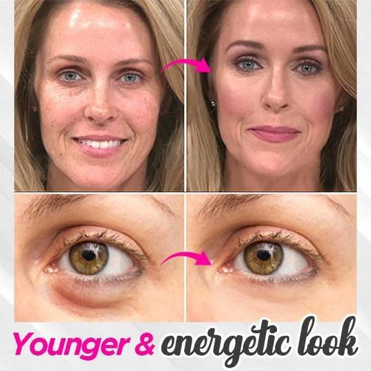💥Daily Sales of 3000+🔥 2025 Hot Sale Brightening-Instant Eye Temporary Eye Tightener