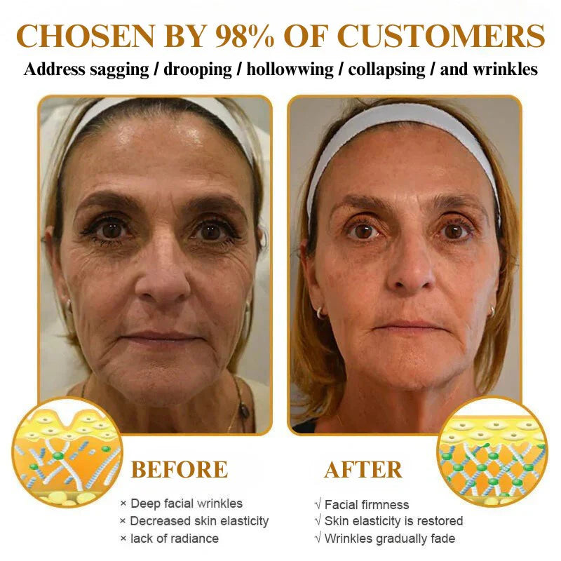 SIJIYUTA Anti Wrinkle Face Cream🔥Buy 3 Get 3 Free🔥