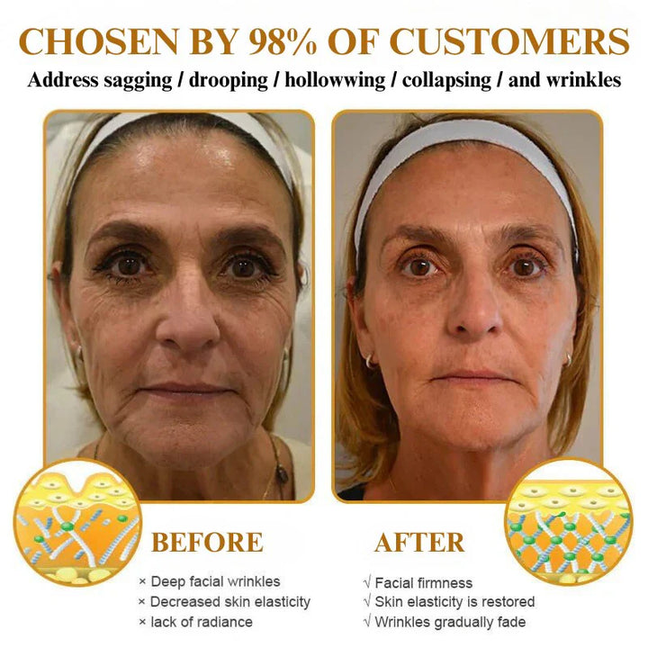 SIJIYUTA Anti Wrinkle Face Cream🔥Buy 3 Get 3 Free🔥