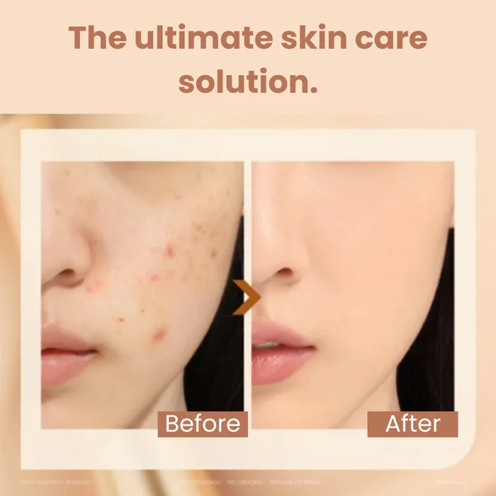 🔥HOT SALE🔥2 in 1 Foundation Concealer