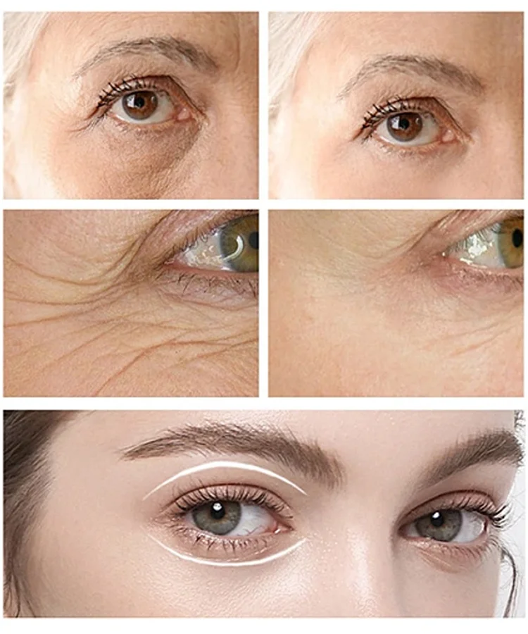 CËLYN FIRM Eye Tightener