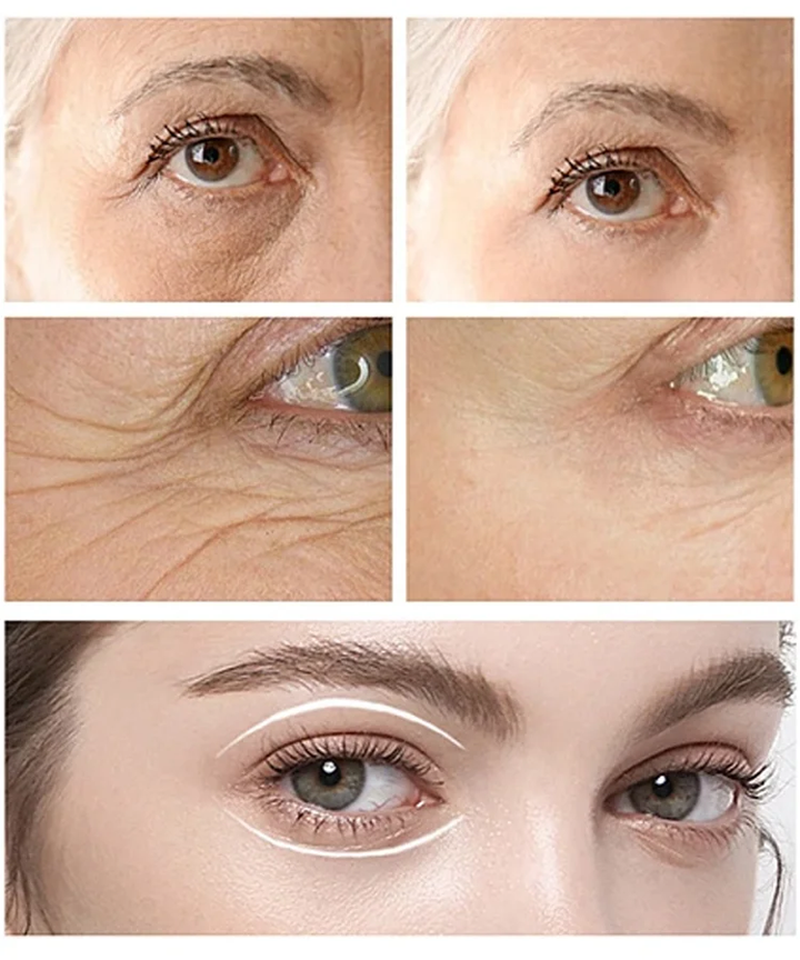 CËLYN FIRM Eye Tightener