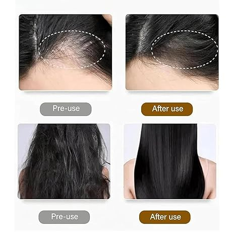 Anti-Hair Loss Shampoo