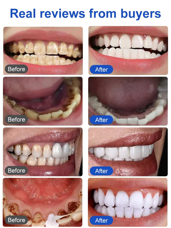 Amino Acid White Toothpaste