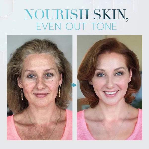 Whitening Skin Melanin Correcting Facial Serum [Experience Flawless Skin, Starting Here!!!]