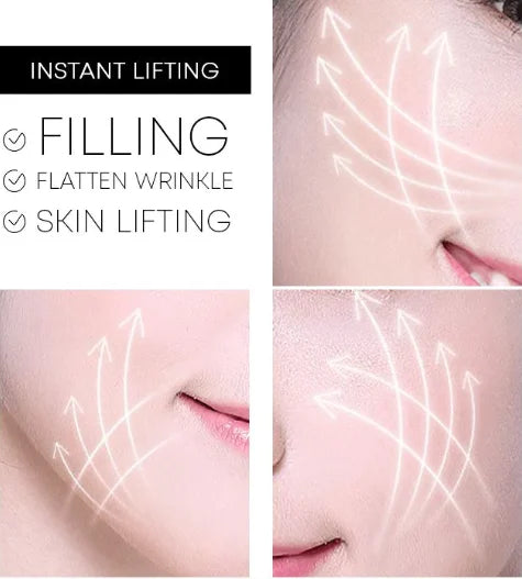 Hot Sale-48% Off Protein Thread Lifting