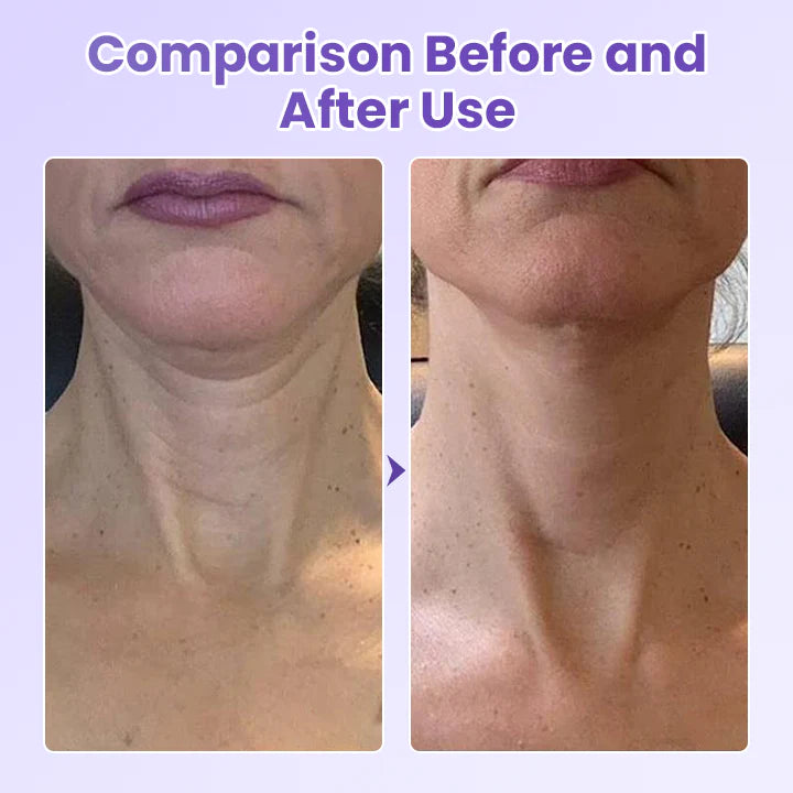 Peptide Anti Wrinkle Patch