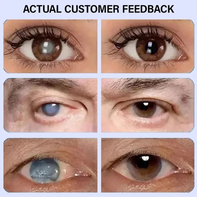 Lutein and Anthocyanin Eye Patches