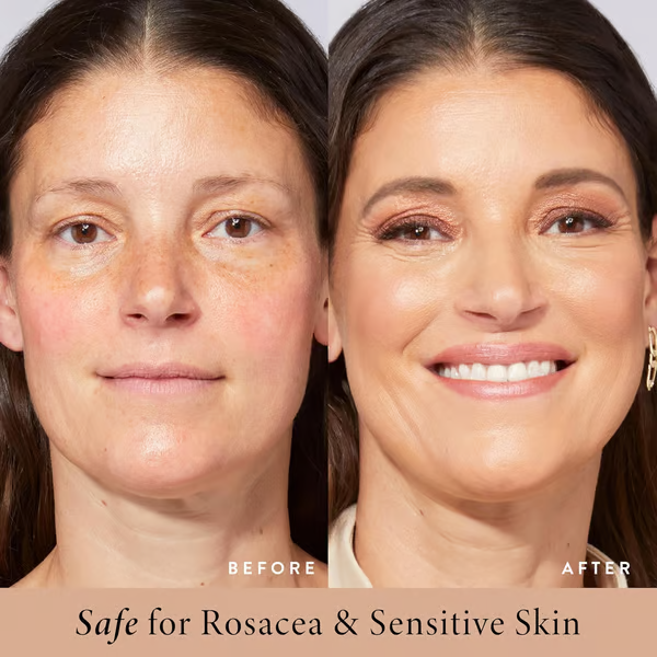 BB moisturizer SPF 30- brightens, hydrates & smooths your skin