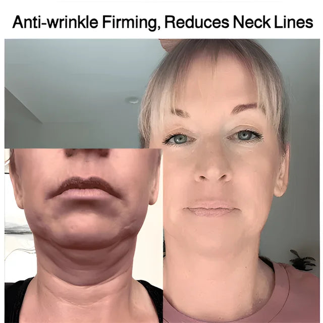 💥BUY 1 GET 1 FREE💥Moisturizing Neck Neck Care Cream