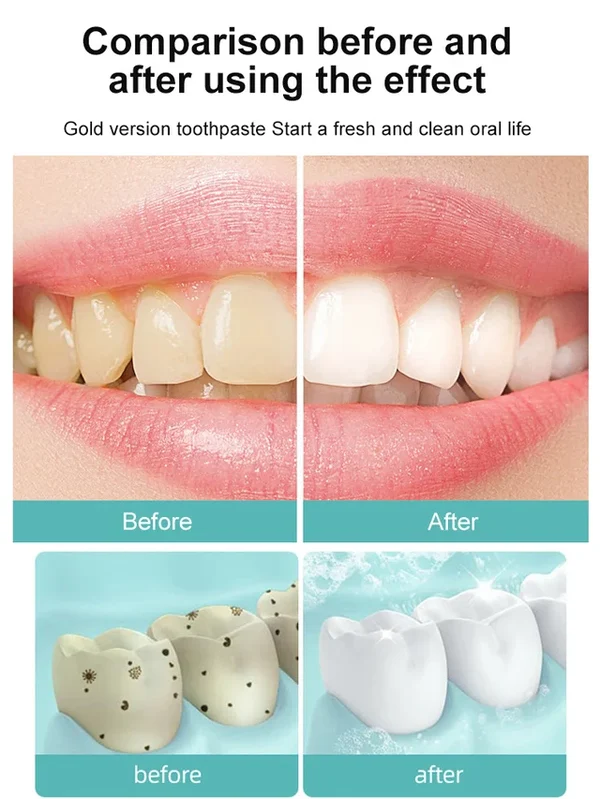 Gold Version Intensive Whitening Toothpaste
