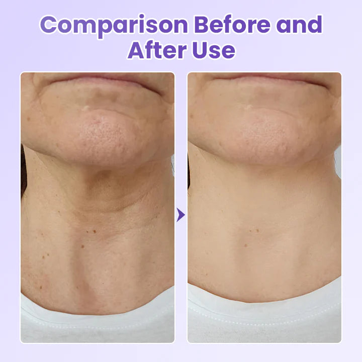 Peptide Anti Wrinkle Patch