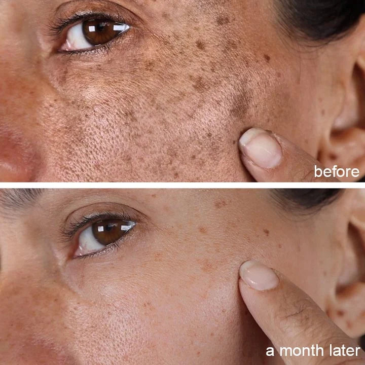 Whitening Skin Melanin Correcting Facial Serum [Experience Flawless Skin, Starting Here!!!]