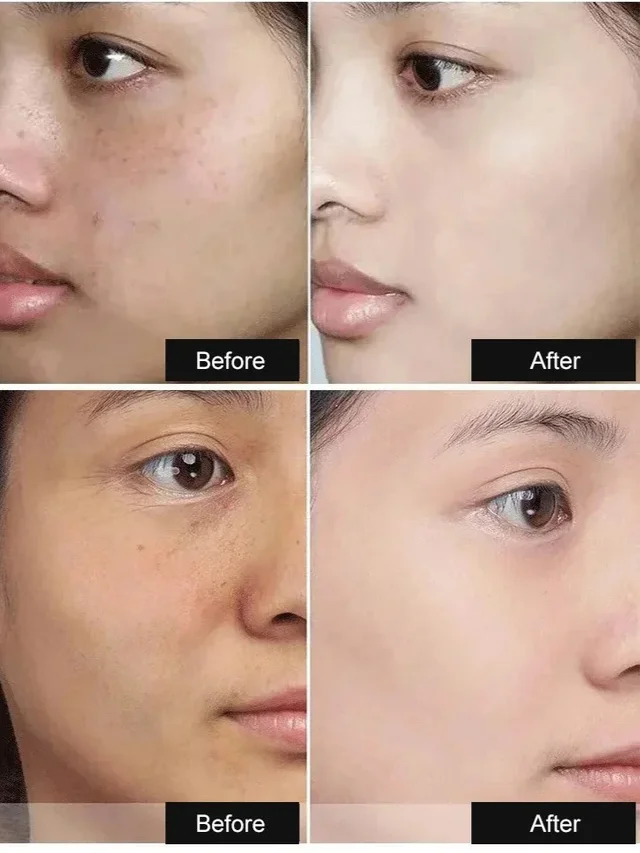 Whitening Spotlight Facial Serum Serum Hydration Extra Brightening Niacinamide Beautiful Skin Serum