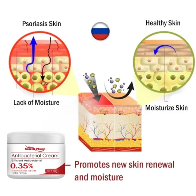 Psoriasis Treatment Cream Moss Repair Itchy Skin Relief