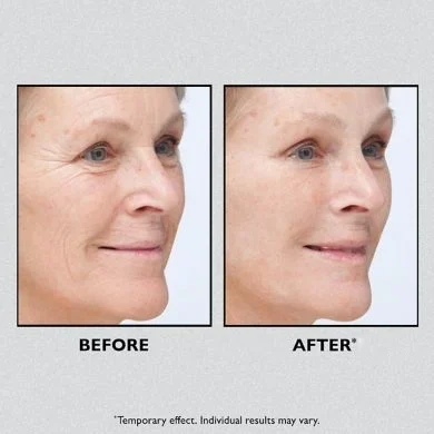 💥Daily Sales of 3000+🔥 2025 Hot Sale Brightening-Instant Eye Temporary Eye Tightener