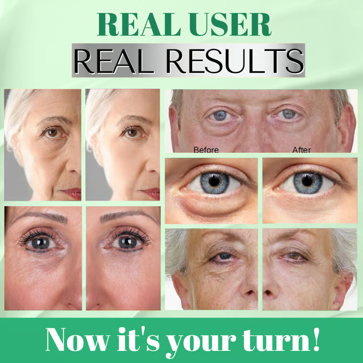 Avocado Moisturizing Collagen Eye bagMask