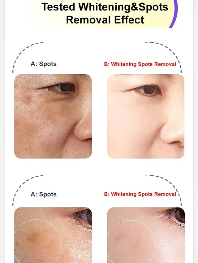Whitening Spotlight Facial Serum Serum Hydration Extra Brightening Niacinamide Beautiful Skin Serum