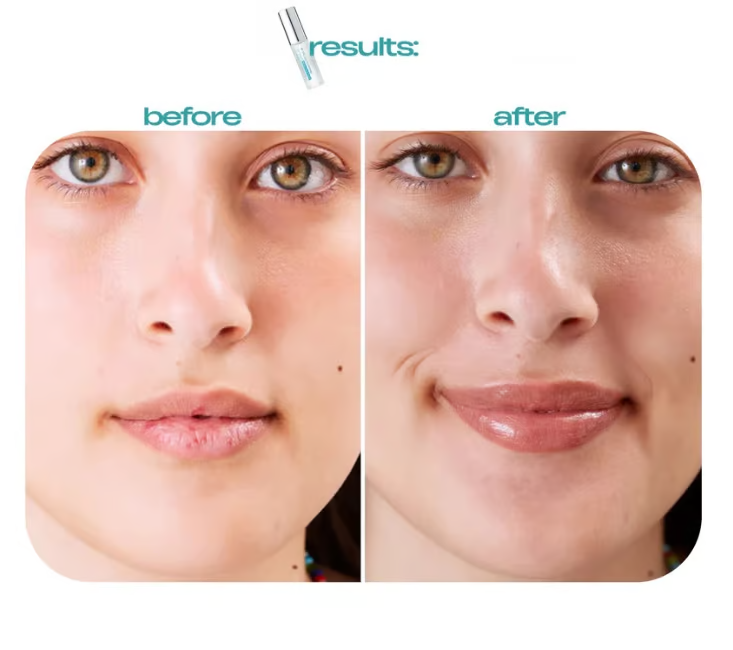 Lip serum Plump and moisturizing lip oil
