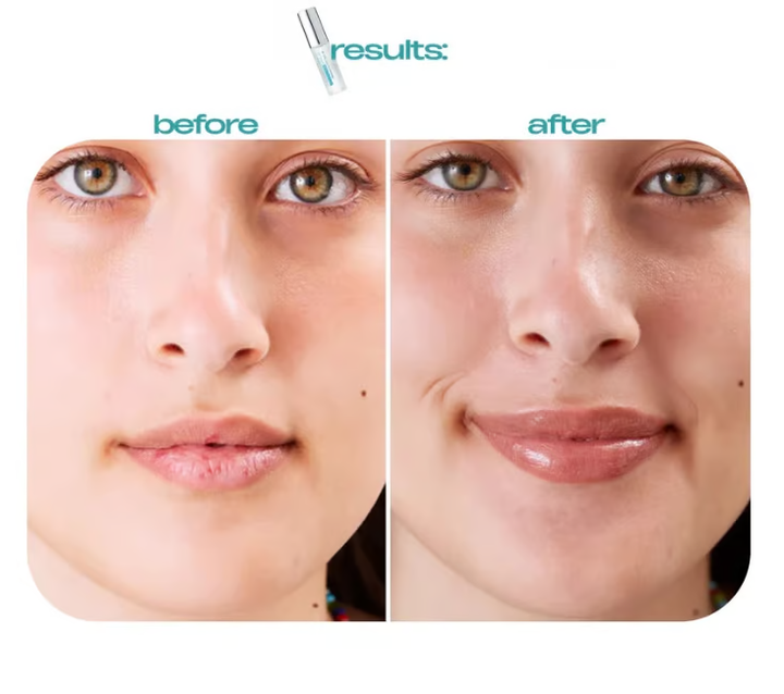 Lip serum Plump and moisturizing lip oil