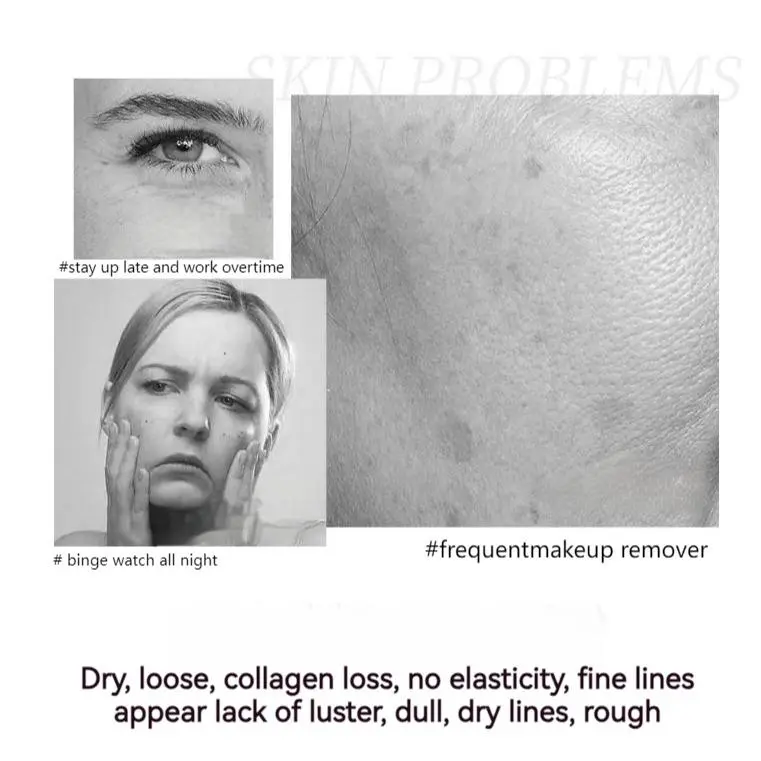 🔥 Buy 1 Get 1 Free🔥2025 Hot Sale Polypeptide Firming Full Face Cream