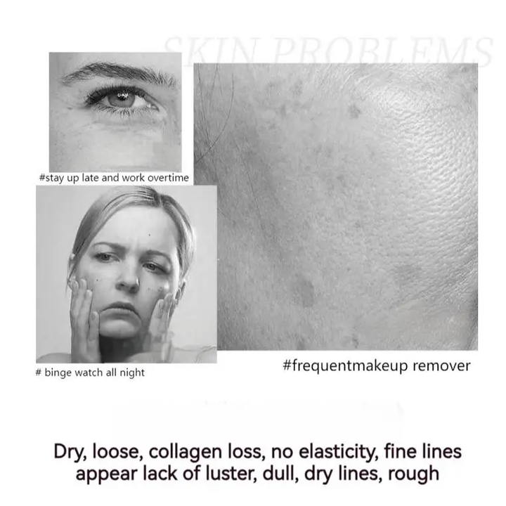 🔥 Buy 1 Get 1 Free🔥2025 Hot Sale Polypeptide Firming Full Face Cream
