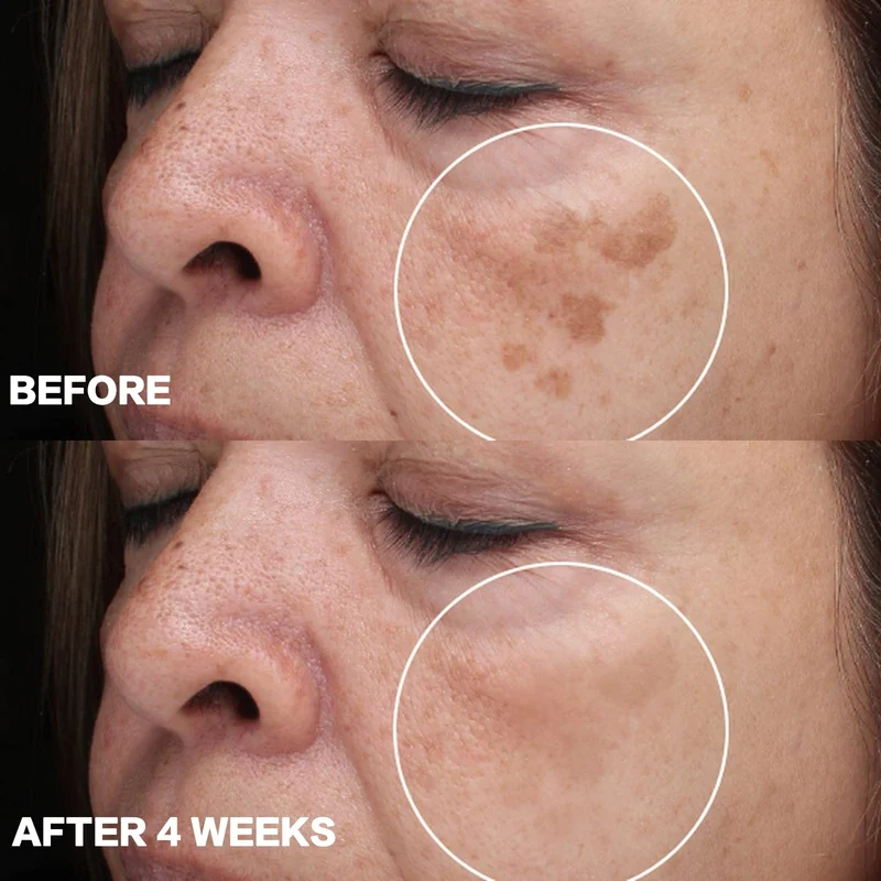 ASMOXA Dark Spot Corrector Cream