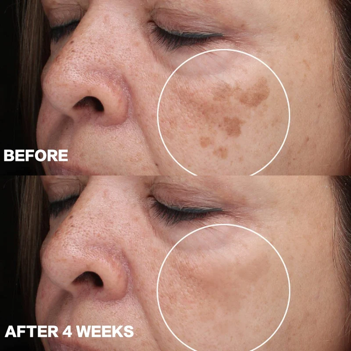 ASMOXA Dark Spot Corrector Cream
