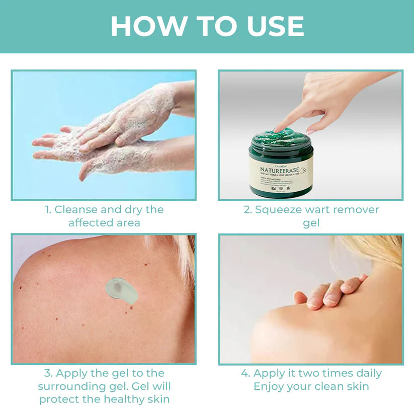 Instant Mole  Spot Removal Gel