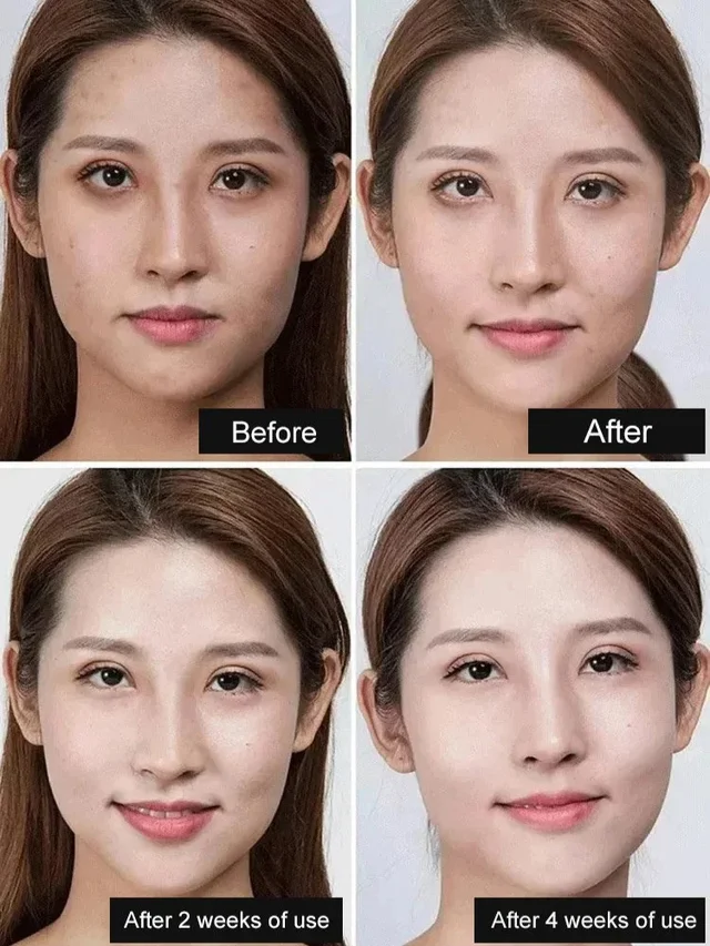 Whitening Spotlight Facial Serum Serum Hydration Extra Brightening Niacinamide Beautiful Skin Serum