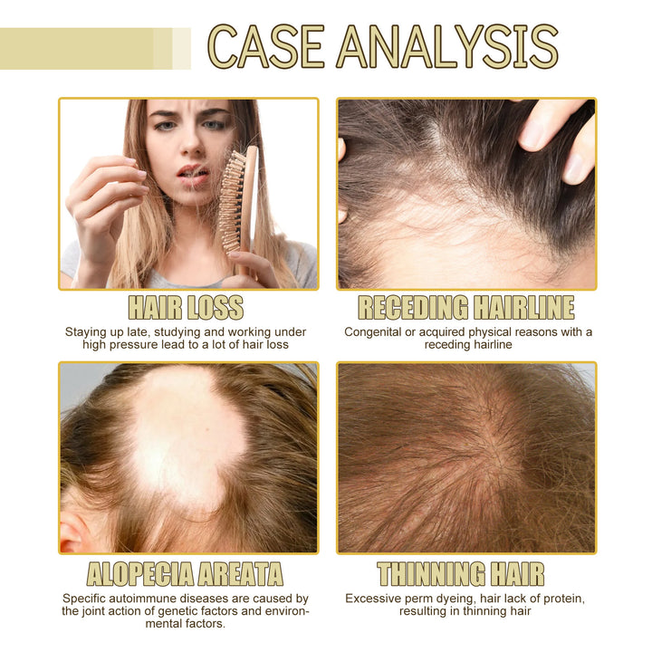 EELHOE thick hair shampoo anti-hair loss smooth strong repair hair care shampoo