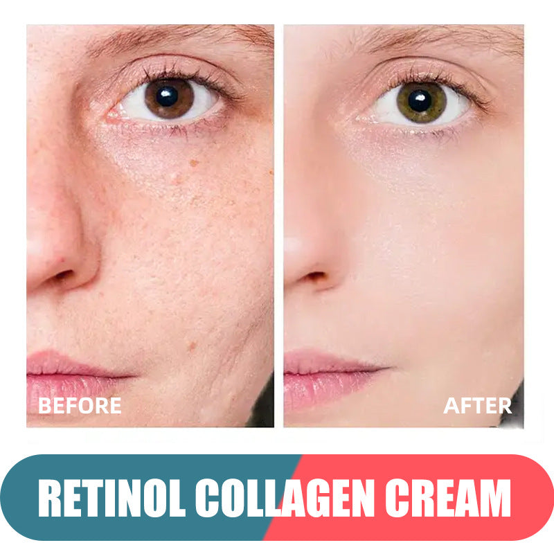Retinol Facial Cream