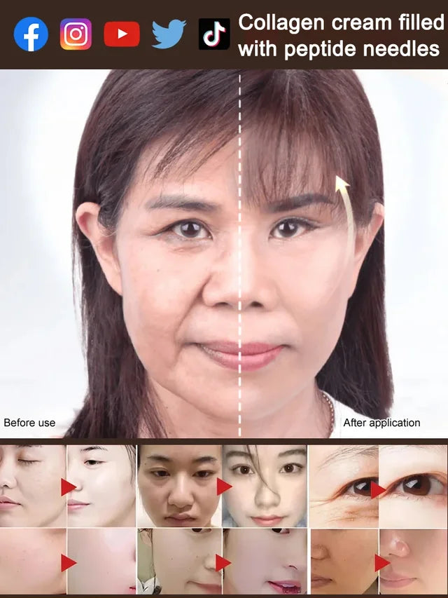 🎁BUY 1 GET 1 FREE🔥Peptide needle-filled collagen cream