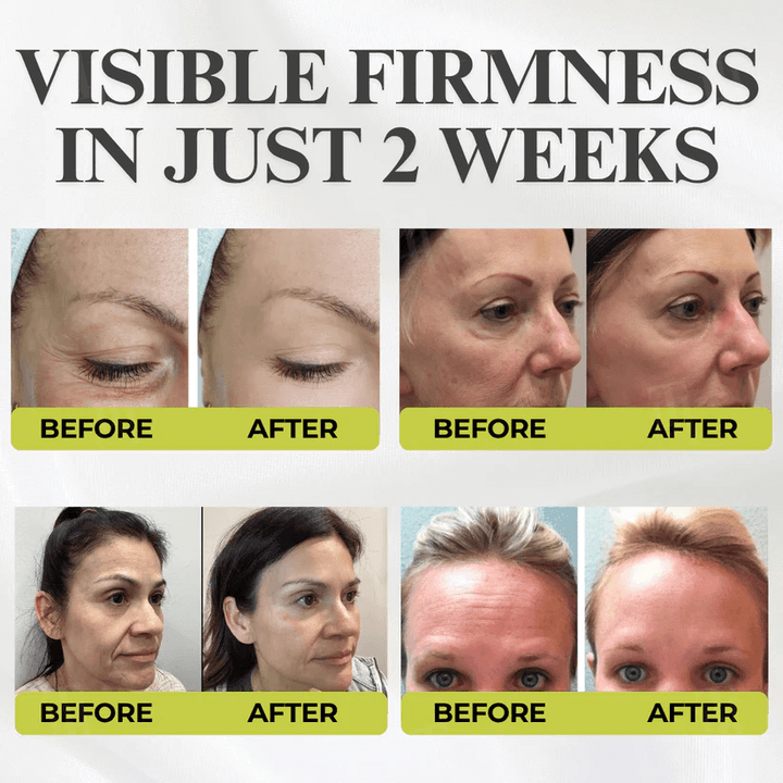 👏🌿Made and shipped from the USA 💫Tiworld® Botox & Vita-A Retinol Shot Wrinkle-Lift Tightening cream - Last Day Promotion 70% OFF