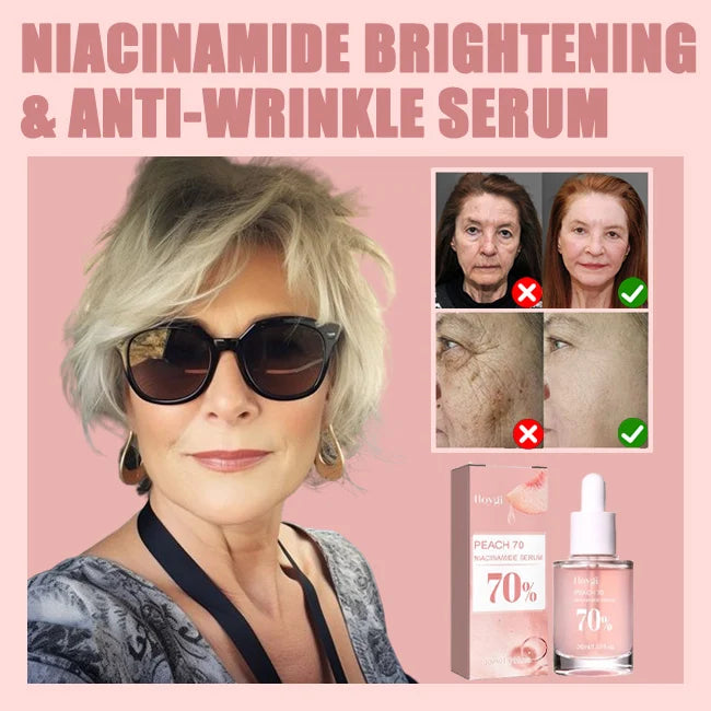 💥Daily Sales of 4000+🔥 2024 Hot Sale Niacinamide Brightening - Moisturizing & Anti-Wrinkle Serum