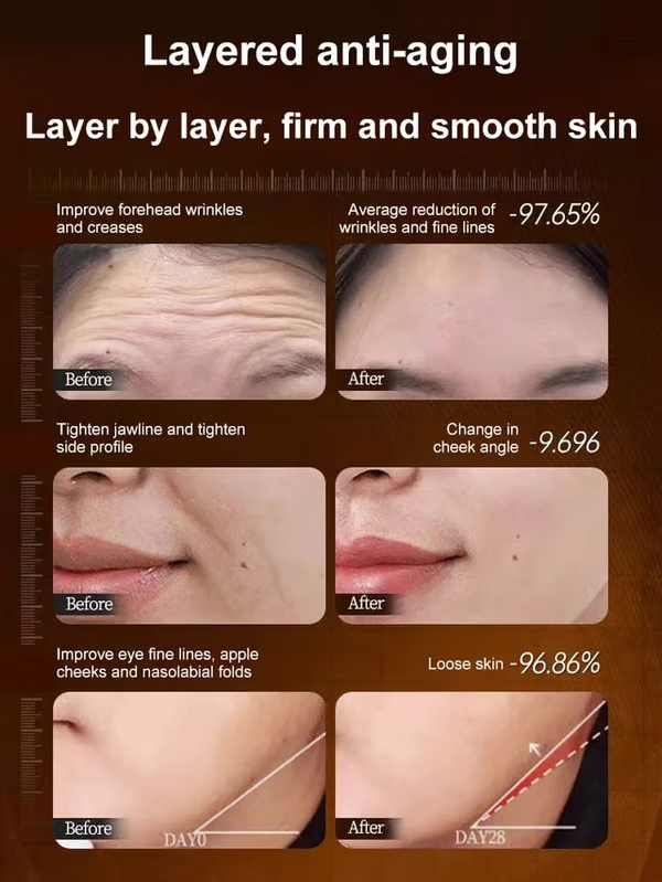 🎁BUY 1 GET 1 FREE🔥Peptide needle-filled collagen cream