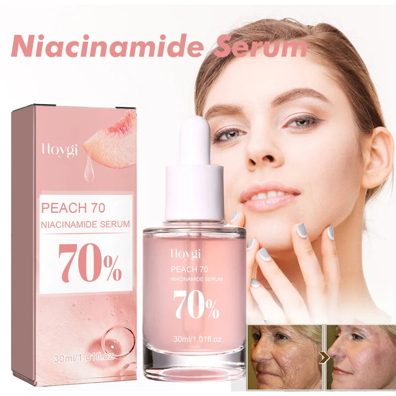 💥Daily Sales of 4000+🔥 2024 Hot Sale Niacinamide Brightening - Moisturizing & Anti-Wrinkle Serum