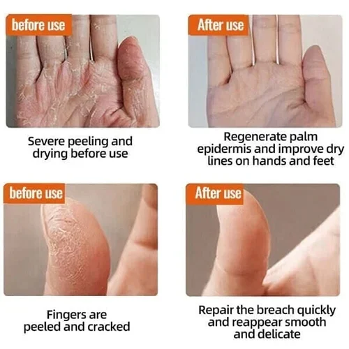 Anti Cracking Frost