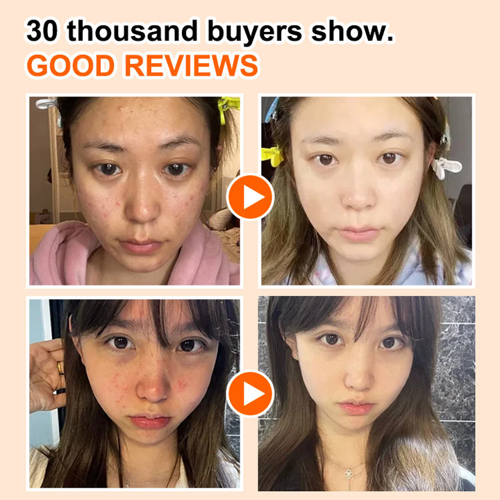 Carrot Bubble Mask Compound Acid Carrot Foam Facial Mask