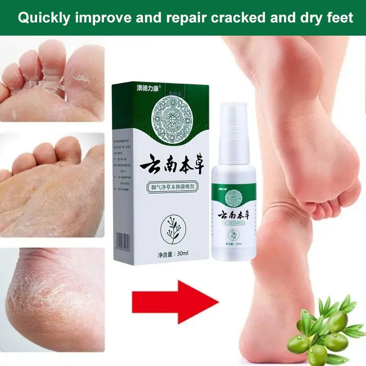 Athletes foot treatment herbal antibacterial spray