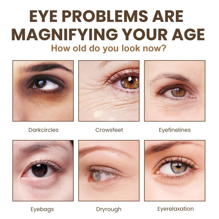 Magic Eye Cream