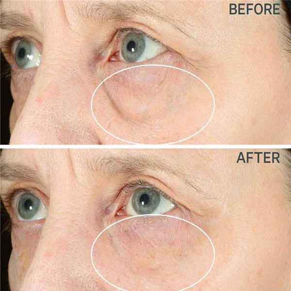 Caviar Essence Anti wrinkle Eye Cream