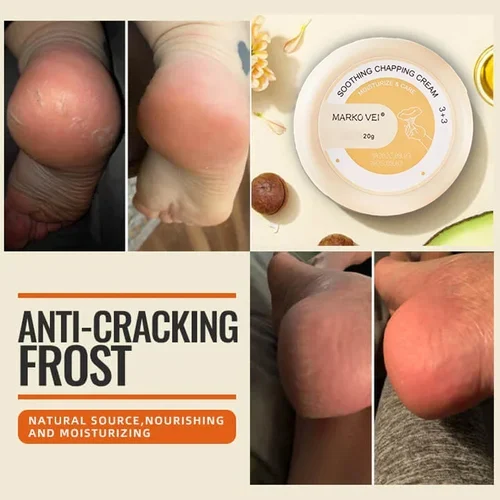 Anti Cracking Frost