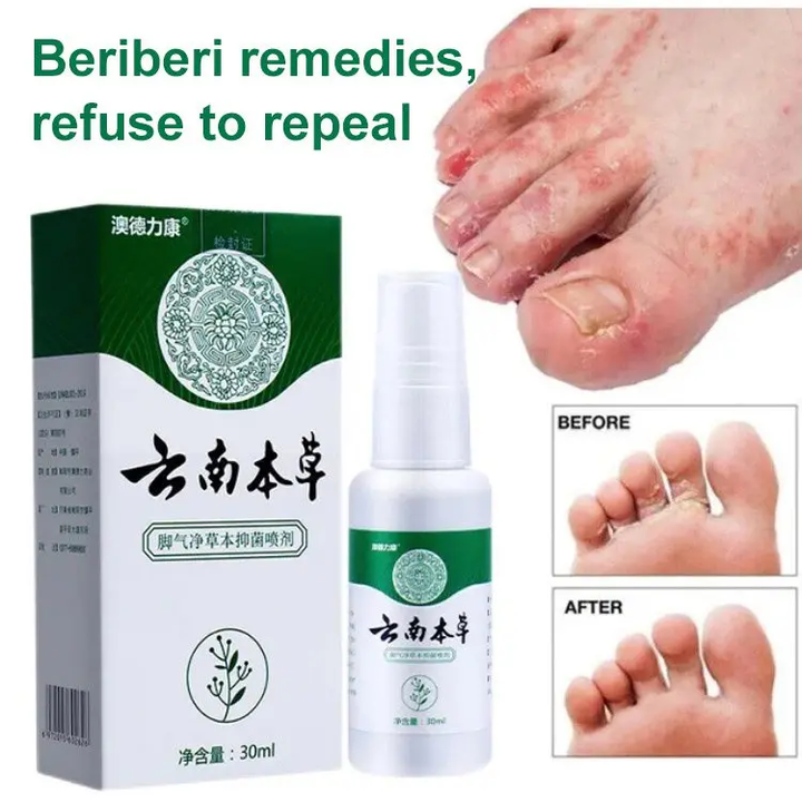 Athletes foot treatment herbal antibacterial spray