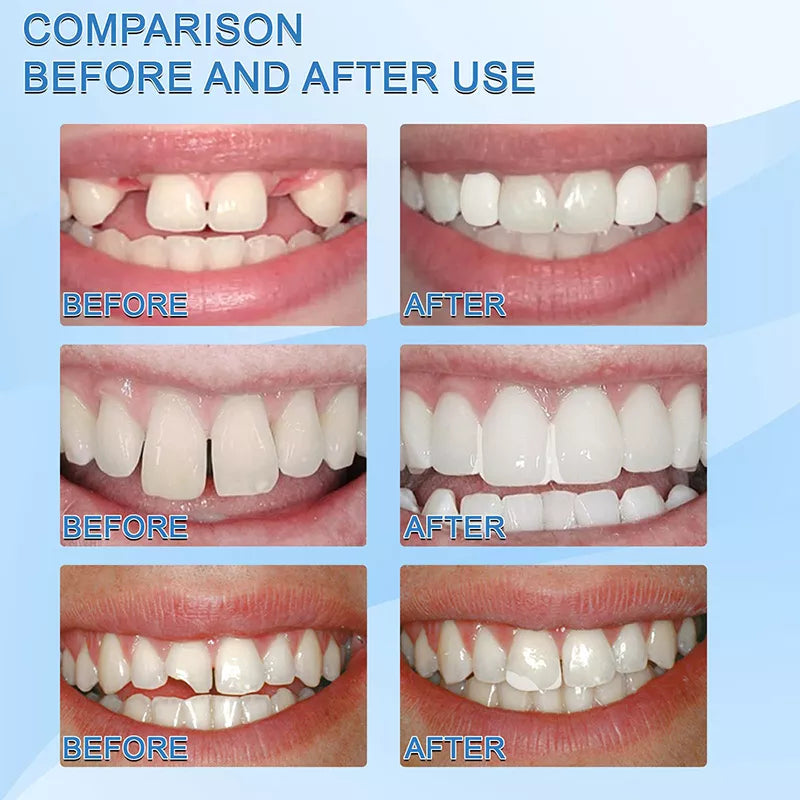TOOTH REPAIR GRANULES