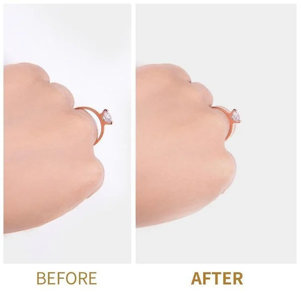 Ring Re sizer Set